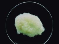 Gestacijski mjehurić u 6-om tjednu gestacije, 2x3 cm ©gynmed